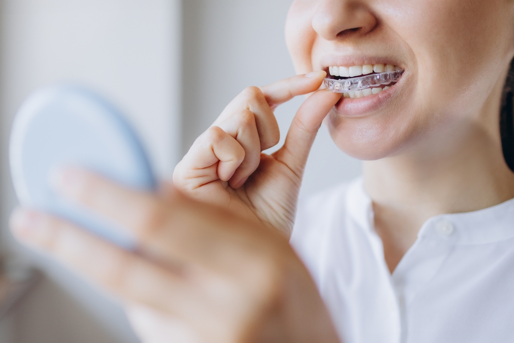 Clear Aligners vs. Braces for Anxious Patients
