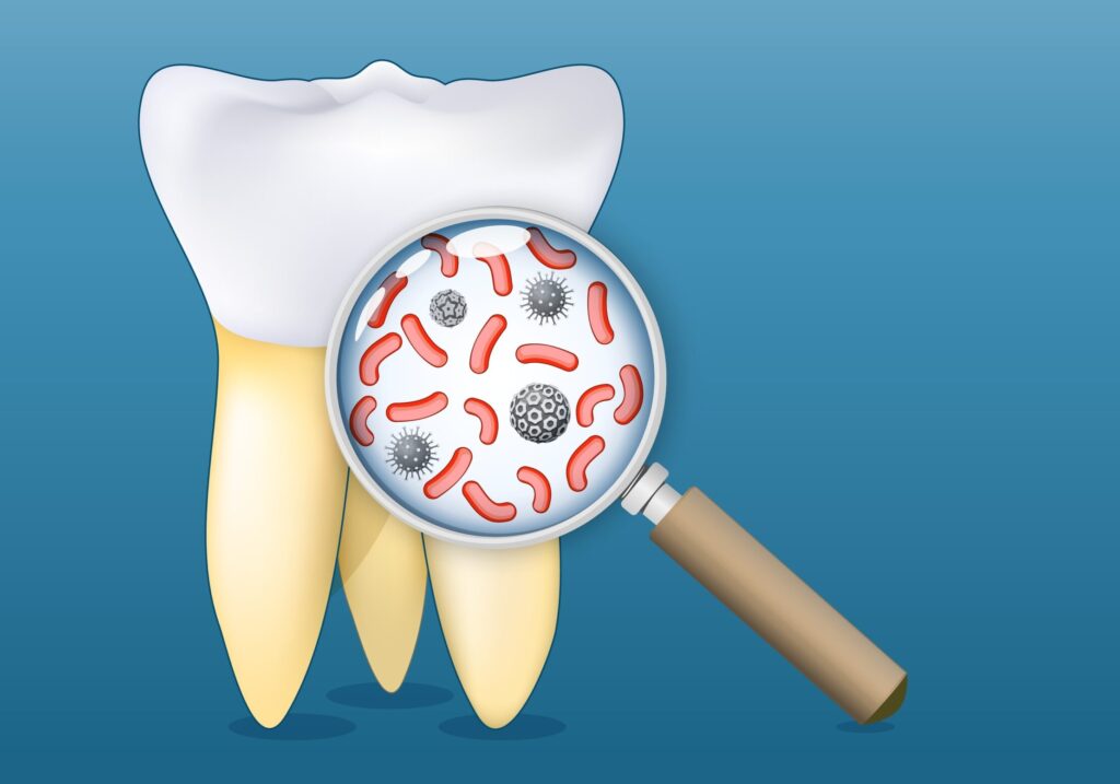 What Is Guided Biofilm Therapy